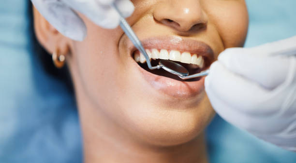 Best Emergency Dentist for Lost Fillings or Crowns in Batavia, IL